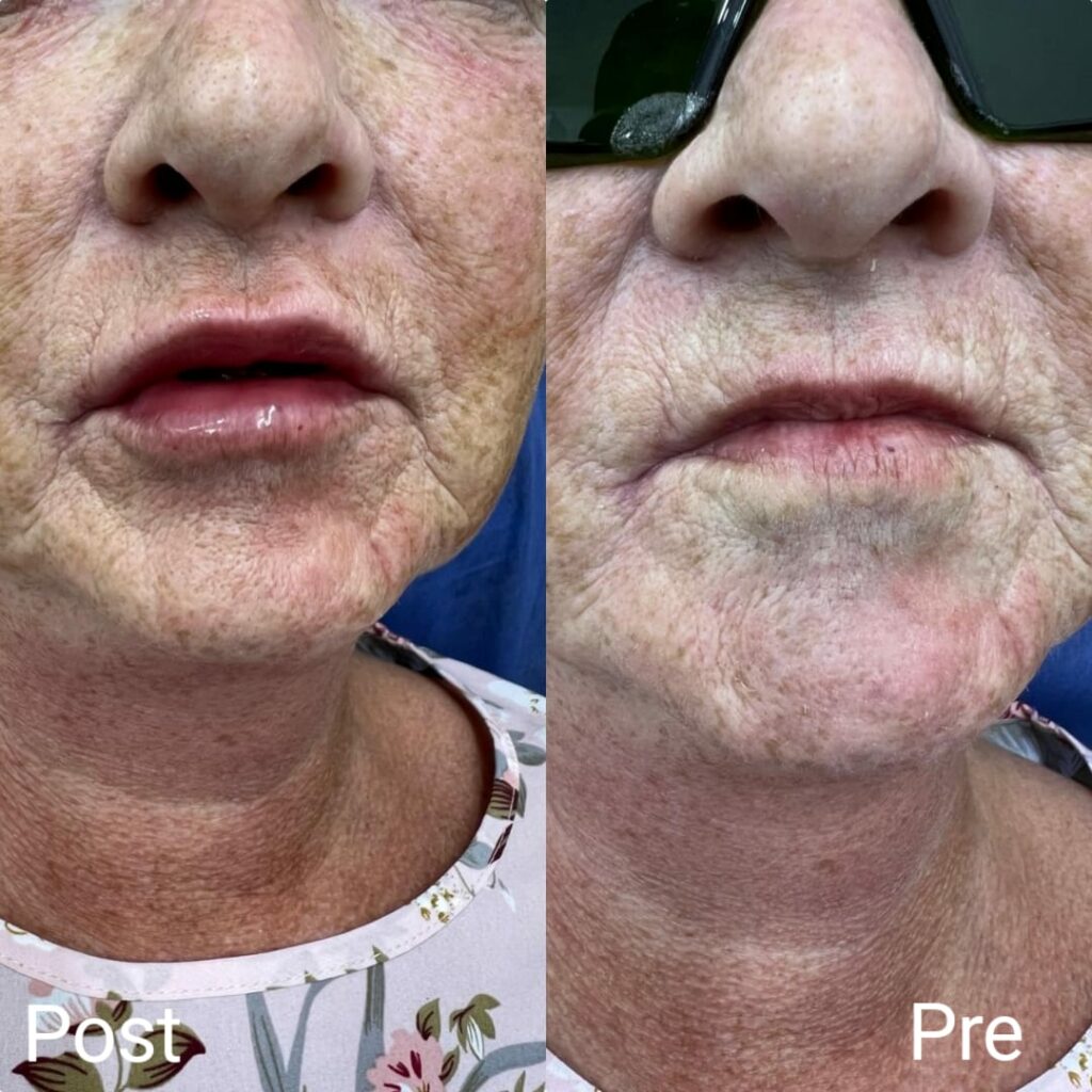 علاج الشيخوخة والعناية بالبشرة